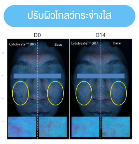 ไวท์เทนนิ่ง - Cytolysate™ 2